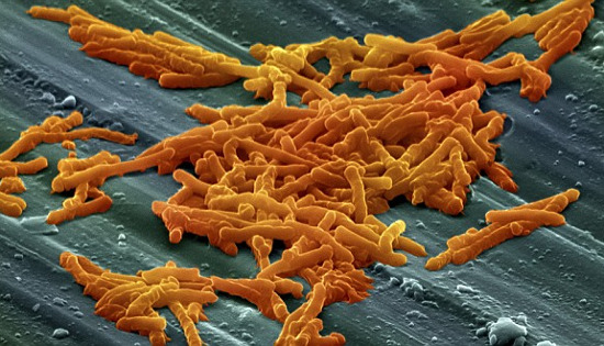 Vi khuẩn Clostridium difficile gây ra bệnh đại tràng