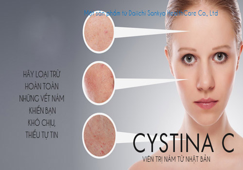 Cystina C loại trừ hoàn toàn những vết nám khiến bạn khó chịu mất tự tin 