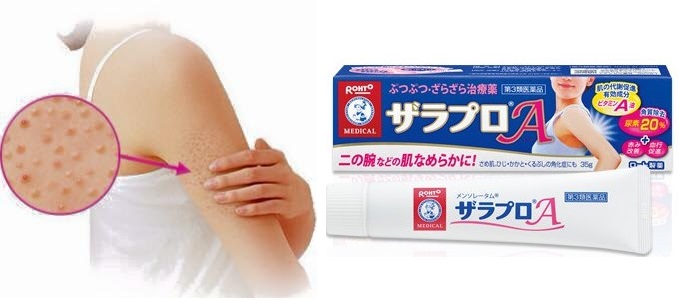 Dùng kem trị viêm nang lông Zaraporo Rohto Nhật Bản đúng cách