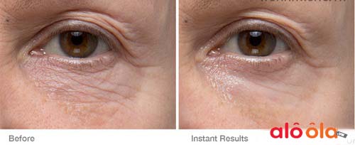 Công dụng trẻ hóa vùng da mắt chống nếp nhăn tuyệt vời của tinh chất instant eye repair treatment