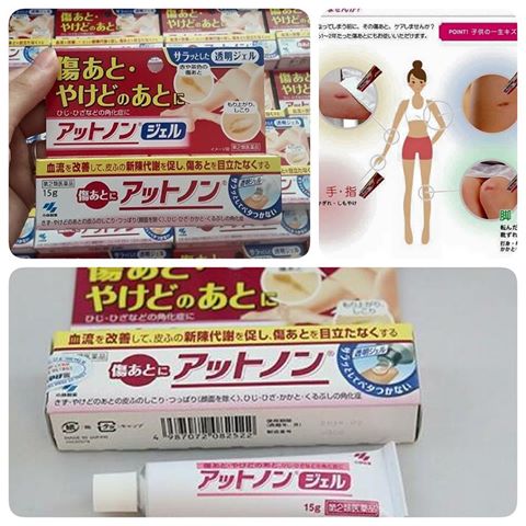 Công dụng của kem trị sẹo Kobayashi Attonon Nhật Bản 15g - đánh bay sẹo hiệu quả