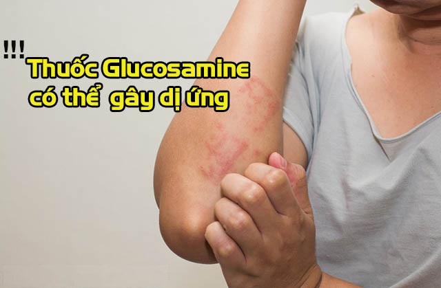 tác dụng phụ của Glucosamine