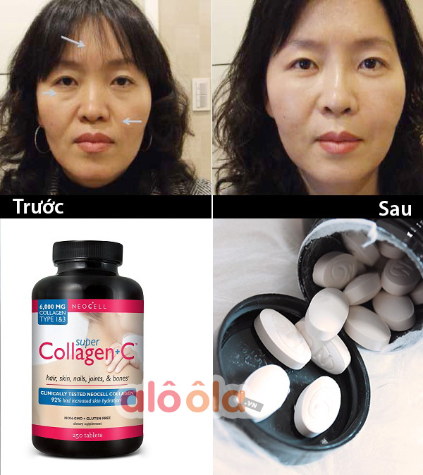 Super Collagen cho làn da đẹp hiệu quả