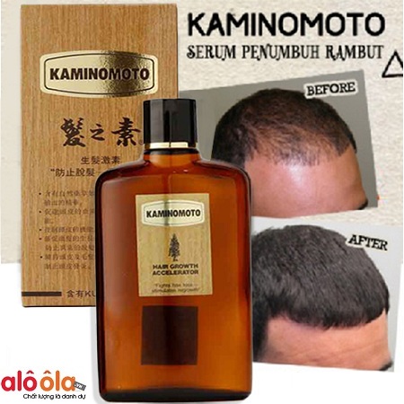 4 Công Dụng Của Thuốc Mọc Tóc Kaminomoto Hair Growth Accelerator