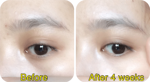 Hiệu quả sau khi dùng kem mắt Dr.IASO