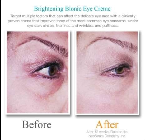kết quả sau khi dùng kem mắt exuviance brightening bionic eye creme plus