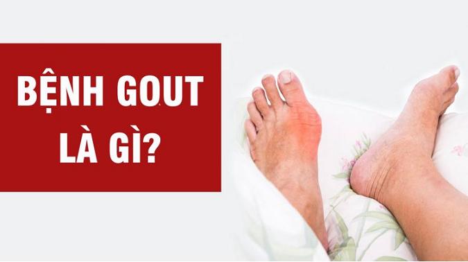 Bệnh gout là gì