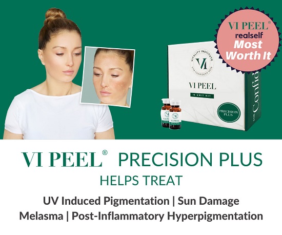 VI Peel Precision Plus – Loại bỏ chứng tăng sắc tố, da không đều màu