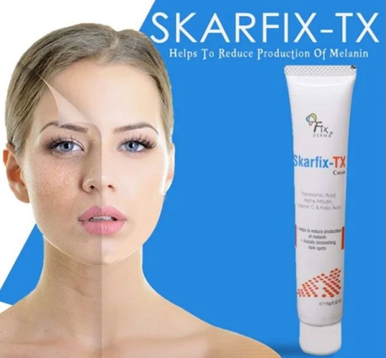 Kem trị nám dưỡng trắng da Fixderma Skarfix-TX Cream 15g