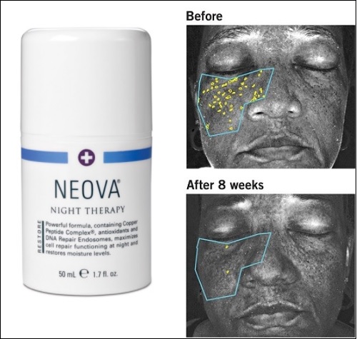 Kem dưỡng cấp ẩm ban đêm Neova Night Therapy 50ml 