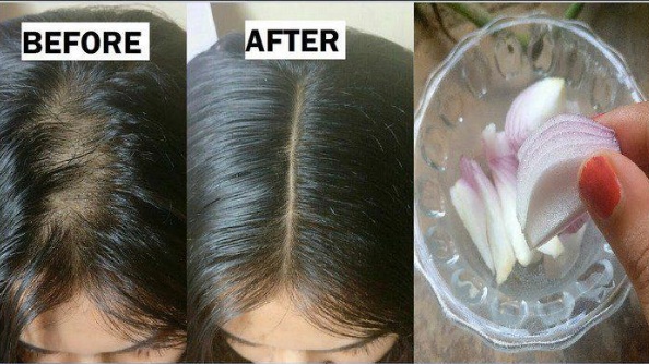 5 cách giúp tóc mọc dày trở lại hiệu quả