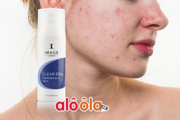 Trị mụn giảm nhờn Image Clear Cell Medicated Acne Lotion