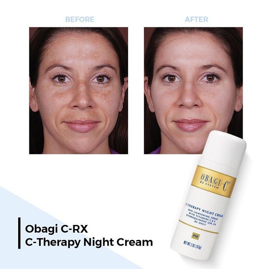 Kem dưỡng trị nám da ban đêm Obagi C Rx System C Therapy Night Cream