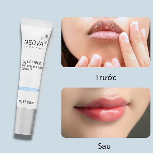 hiệu quả khi sử dụng  neova cu3 lip repair